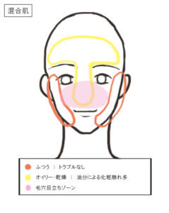 顔面トラブル分布